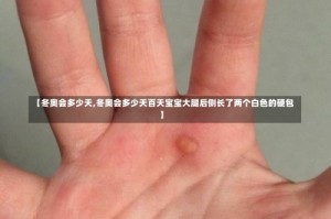【冬奥会多少天,冬奥会多少天百天宝宝大腿后侧长了两个白色的硬包】