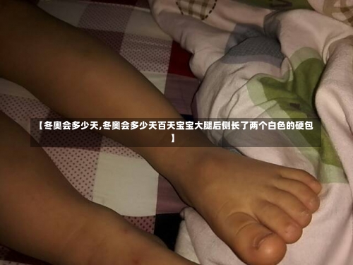 【冬奥会多少天,冬奥会多少天百天宝宝大腿后侧长了两个白色的硬包】-第2张图片