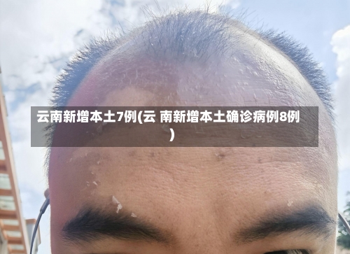 云南新增本土7例(云 南新增本土确诊病例8例)-第2张图片